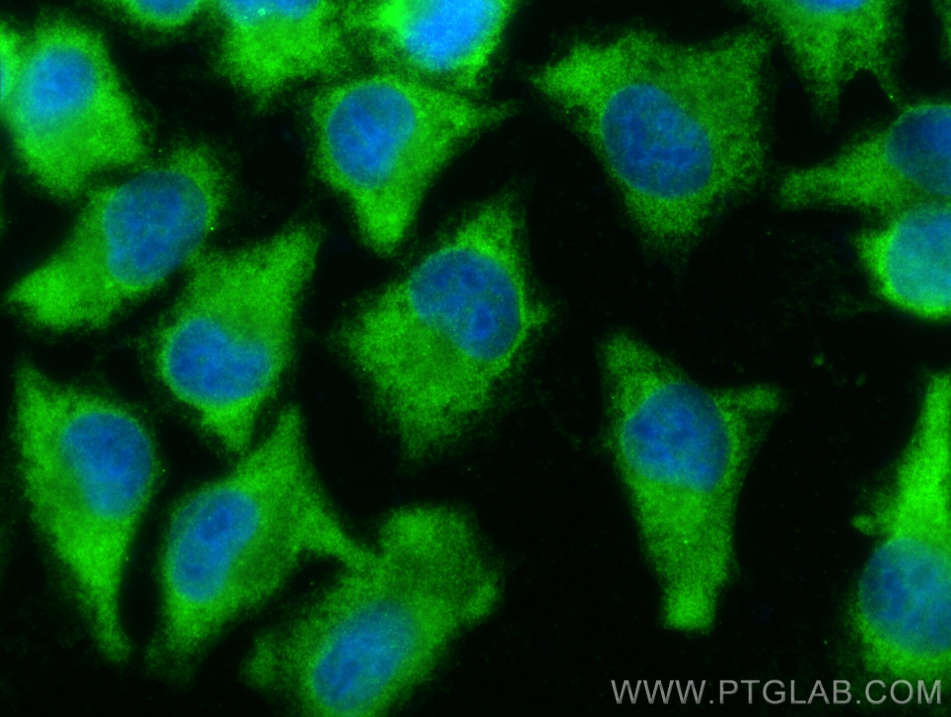 Immunofluorescence (IF) / fluorescent staining of A375 cells using C7orf58 Polyclonal antibody (20924-1-AP)