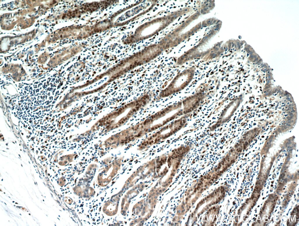 Immunohistochemistry (IHC) staining of human stomach tissue using C7orf58 Polyclonal antibody (20924-1-AP)