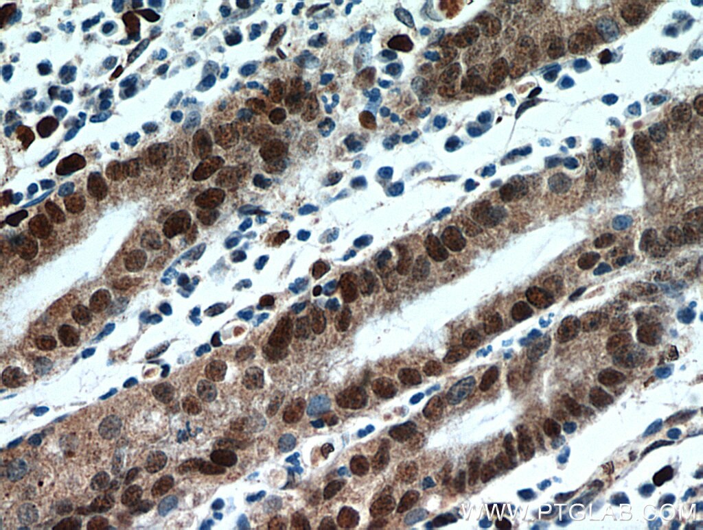 Immunohistochemistry (IHC) staining of human stomach tissue using C7orf58 Polyclonal antibody (20924-1-AP)