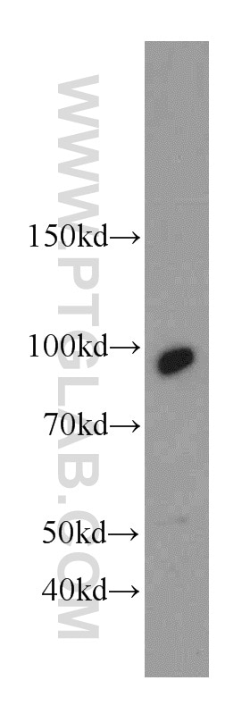 Western Blot (WB) analysis of A431 cells using C7orf58 Polyclonal antibody (20924-1-AP)