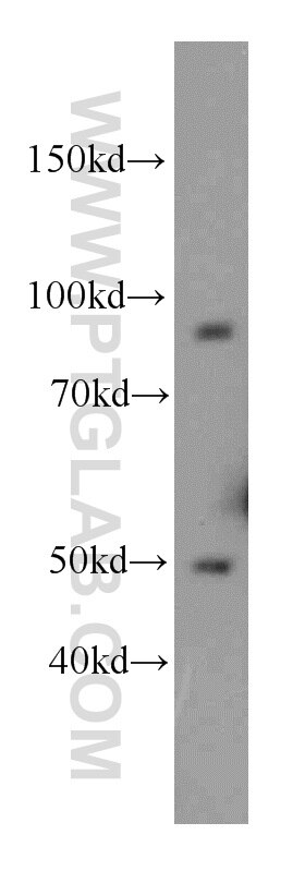 Western Blot (WB) analysis of HeLa cells using C7orf58 Polyclonal antibody (20924-1-AP)
