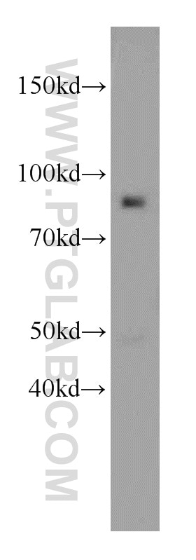 Western Blot (WB) analysis of HEK-293 cells using C7orf58 Polyclonal antibody (20924-1-AP)