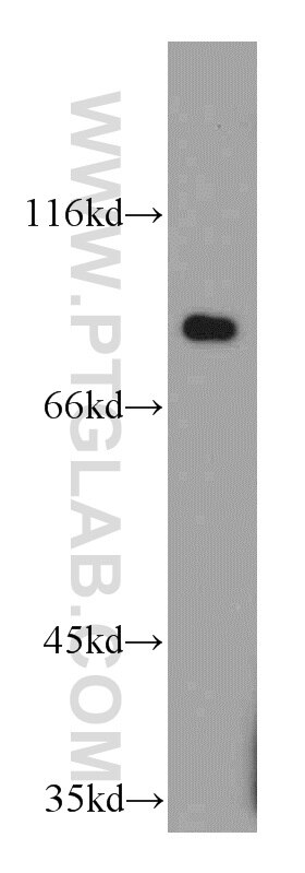 Western Blot (WB) analysis of A375 cells using C7orf58 Polyclonal antibody (20924-1-AP)