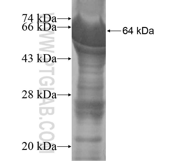 C7orf58 fusion protein Ag15193 SDS-PAGE