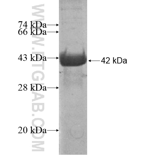 C7orf58 fusion protein Ag15623 SDS-PAGE
