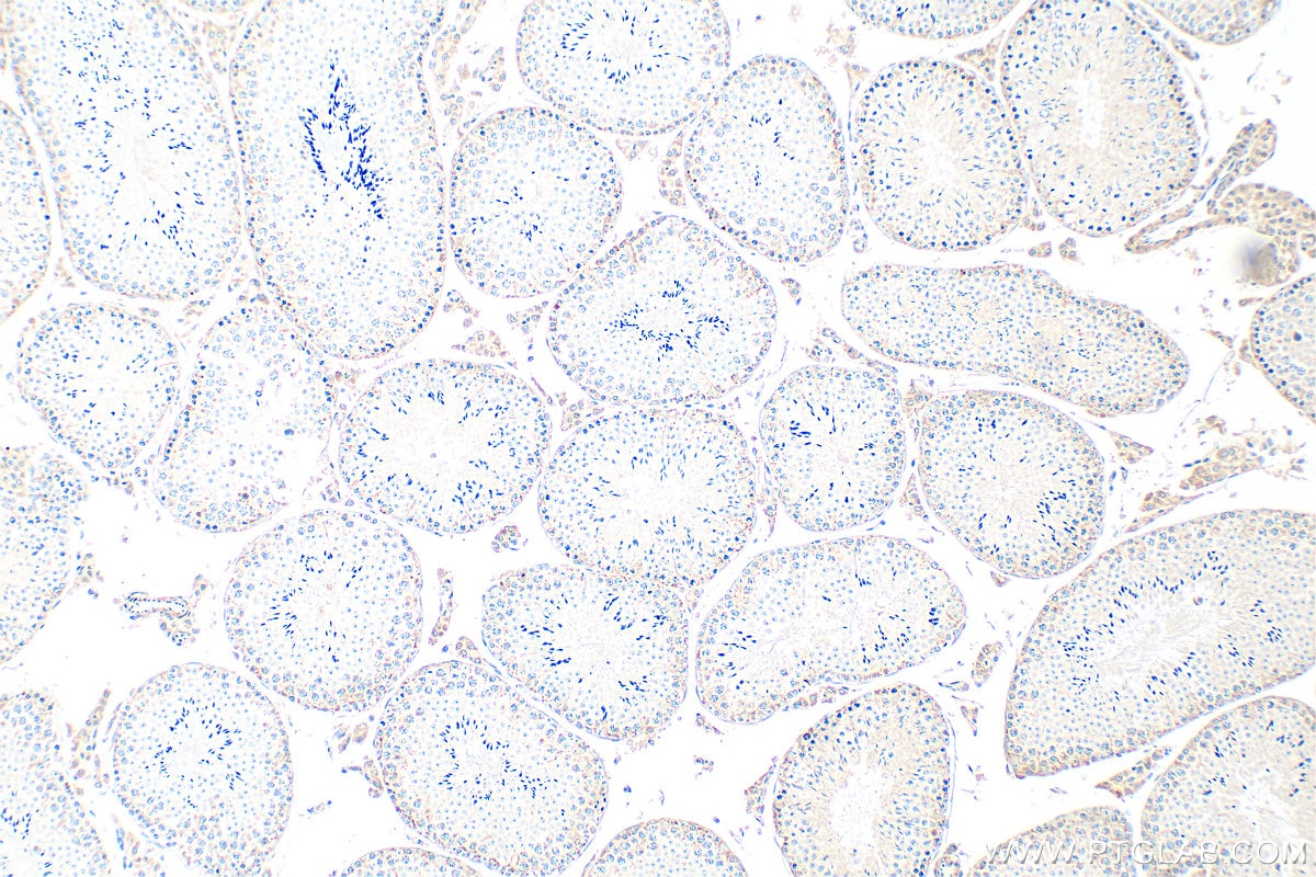 Immunohistochemistry (IHC) staining of mouse testis tissue using C7orf63 Polyclonal antibody (24001-1-AP)