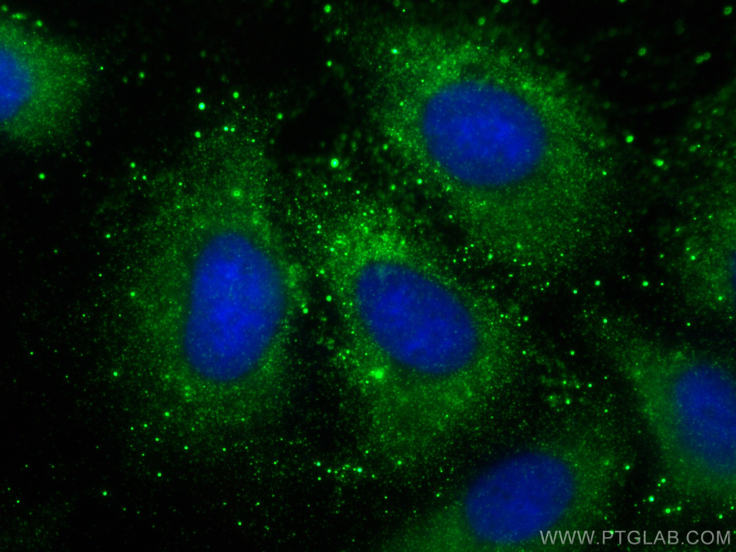 Immunofluorescence (IF) / fluorescent staining of A549 cells using HIG2 Polyclonal antibody (15587-1-AP)