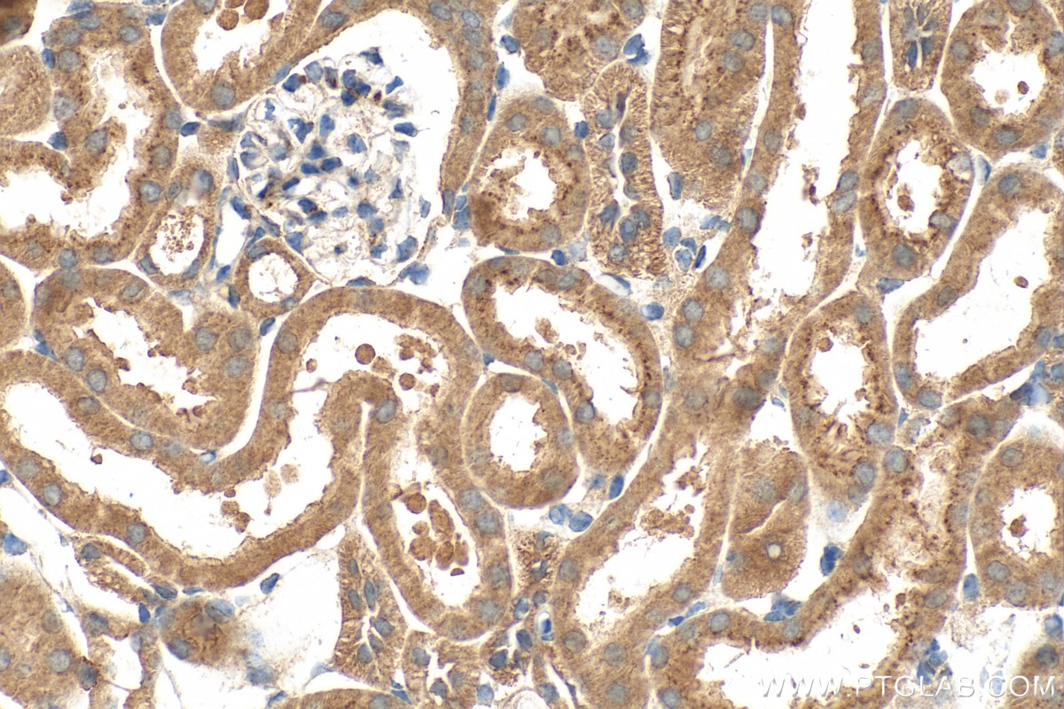 Immunohistochemistry (IHC) staining of mouse kidney tissue using HIG2 Polyclonal antibody (15587-1-AP)