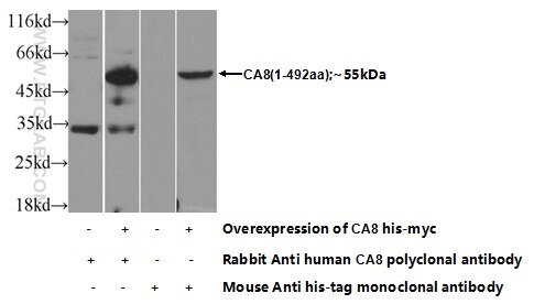 C8A Polyclonal antibody