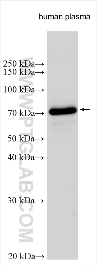 Western Blot (WB) analysis of various lysates using C8A Polyclonal antibody (25289-1-AP)