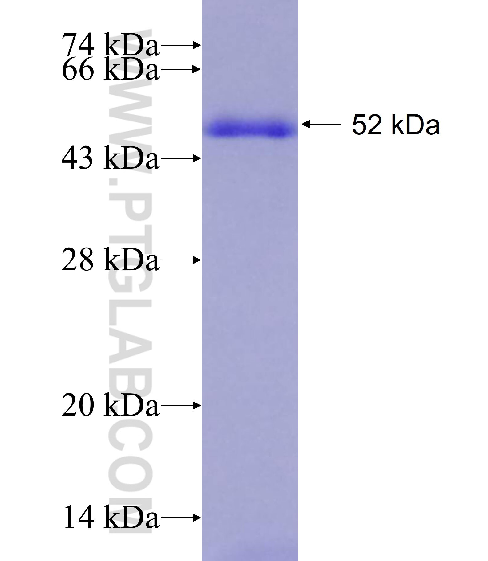 C8A fusion protein Ag18389 SDS-PAGE