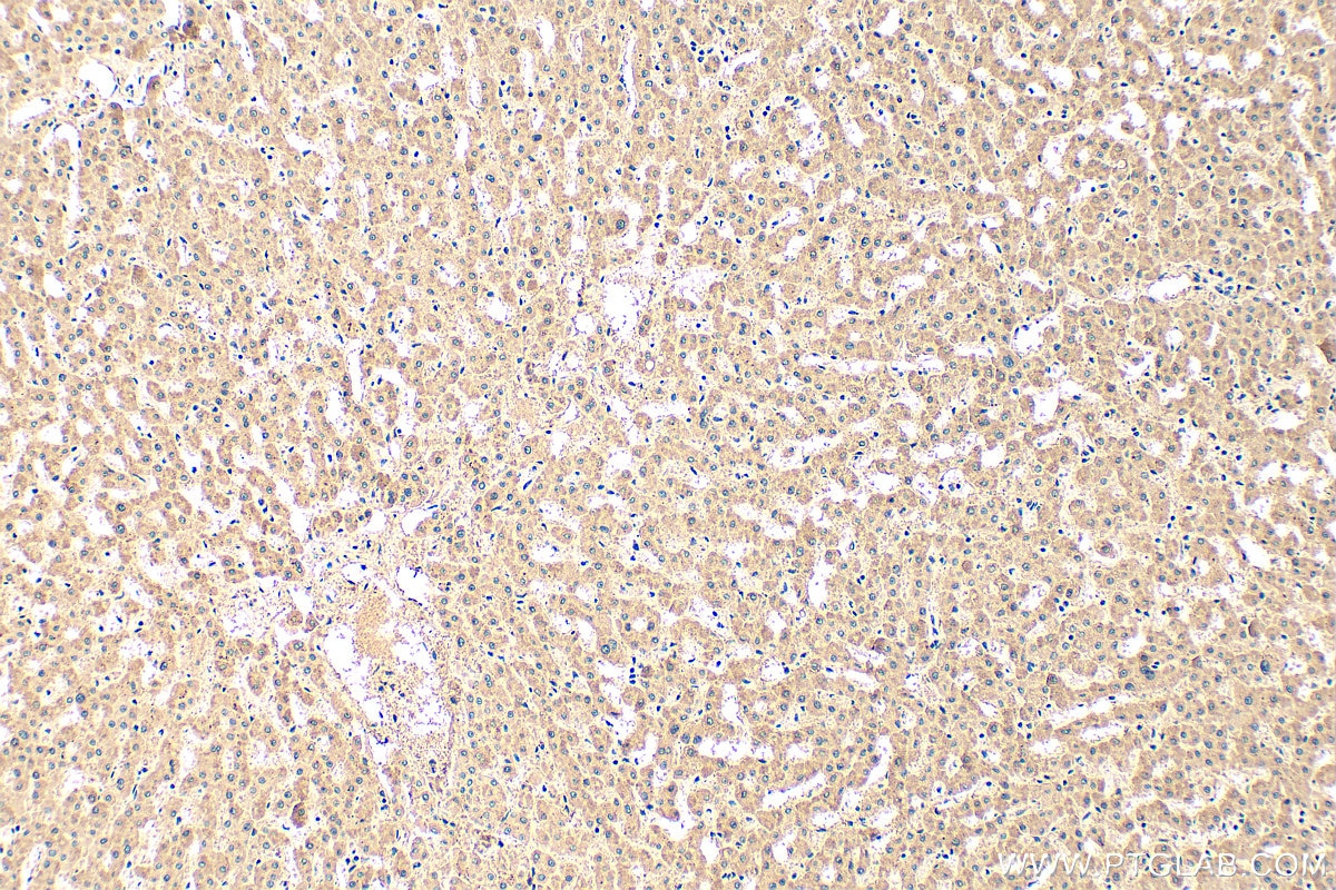 Immunohistochemistry (IHC) staining of human liver tissue using C8B Polyclonal antibody (25184-1-AP)