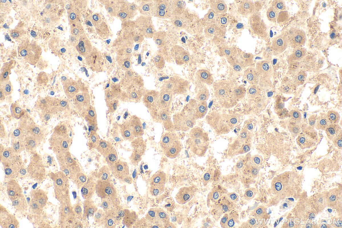 Immunohistochemistry (IHC) staining of human liver tissue using C8B Polyclonal antibody (25184-1-AP)