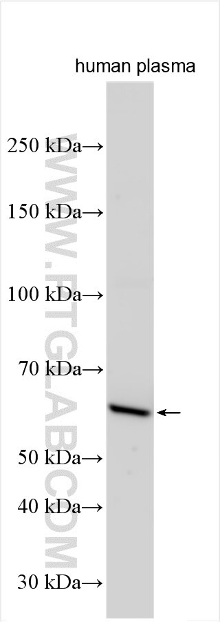 Western Blot (WB) analysis of human plasma using C8B Polyclonal antibody (25184-1-AP)