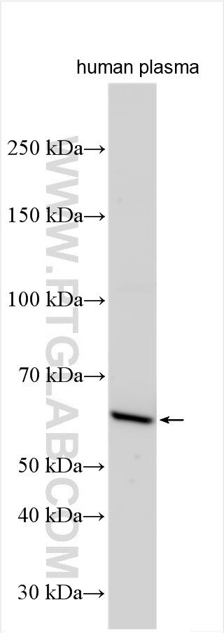 WB analysis of human plasma using 25184-1-AP