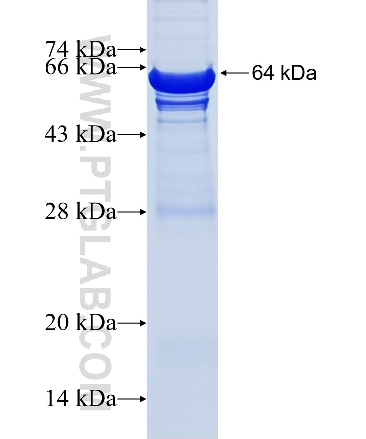 C8B fusion protein Ag18137 SDS-PAGE