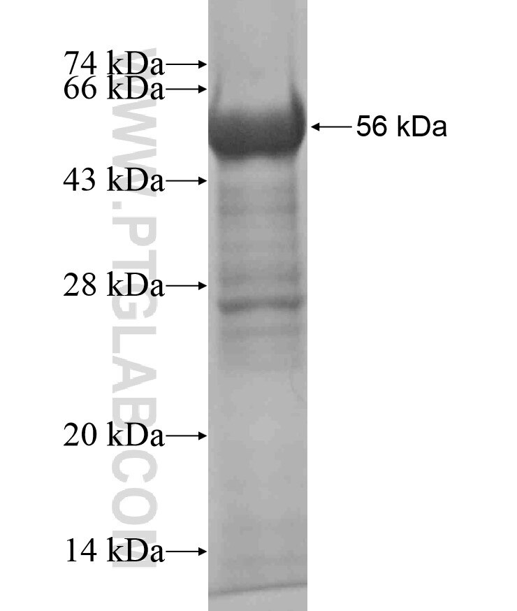 C8B fusion protein Ag18388 SDS-PAGE