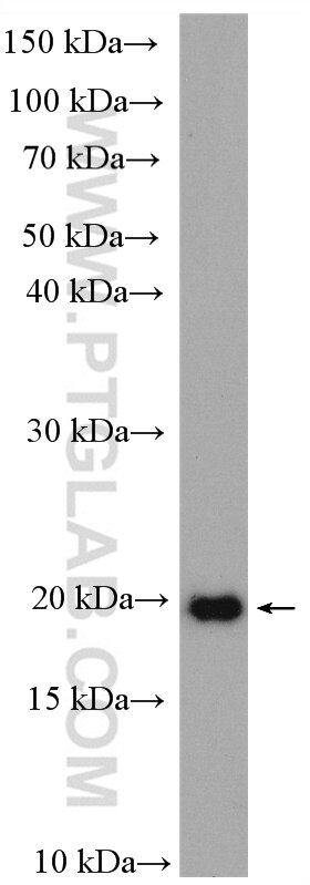 Western Blot (WB) analysis of human placenta tissue using C8G Polyclonal antibody (27200-1-AP)