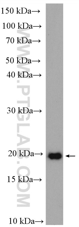 WB analysis of human placenta using 27200-1-AP