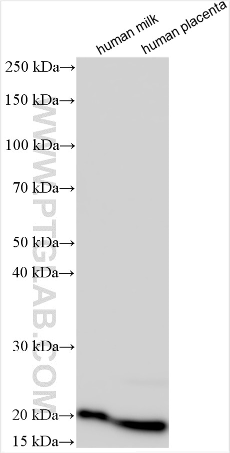 Western Blot (WB) analysis of various lysates using C8G Polyclonal antibody (27200-1-AP)