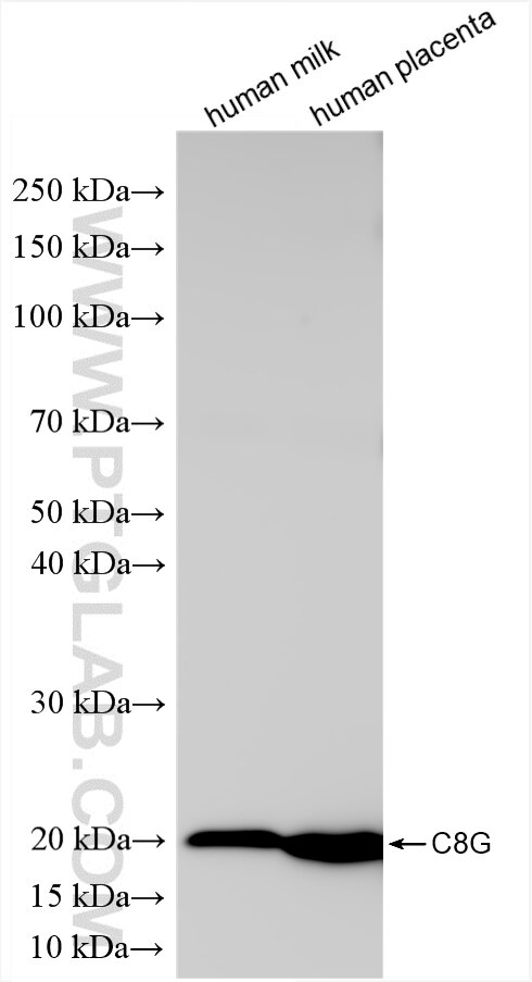 Western Blot (WB) analysis of various lysates using C8G Recombinant antibody (85652-1-RR)