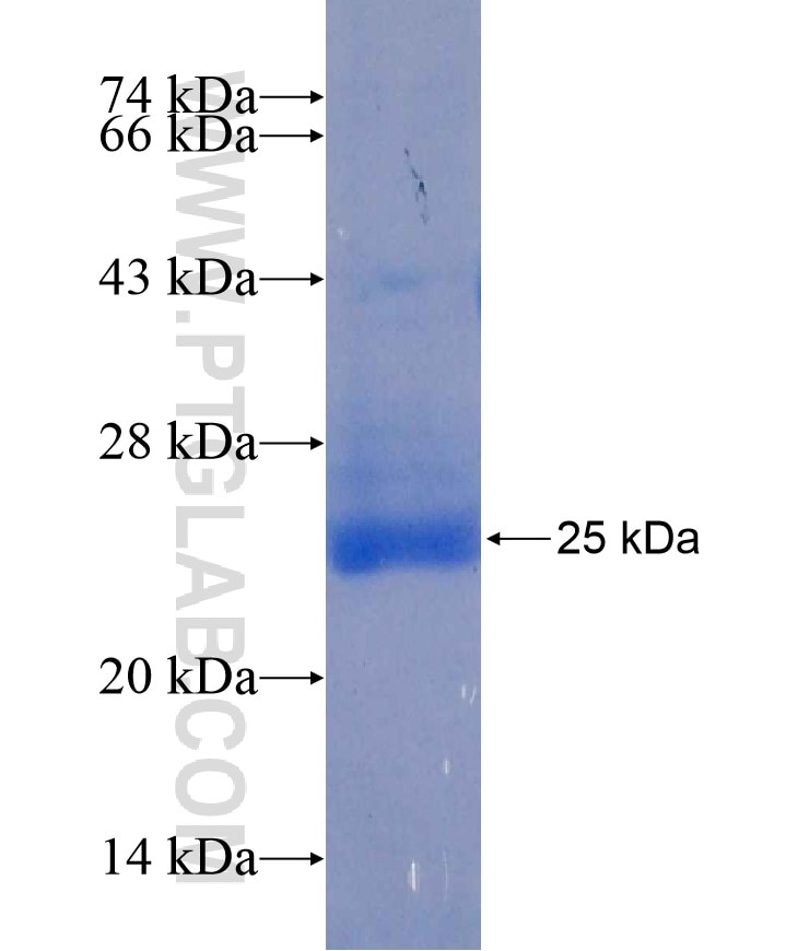 C8G fusion protein Ag18261 SDS-PAGE