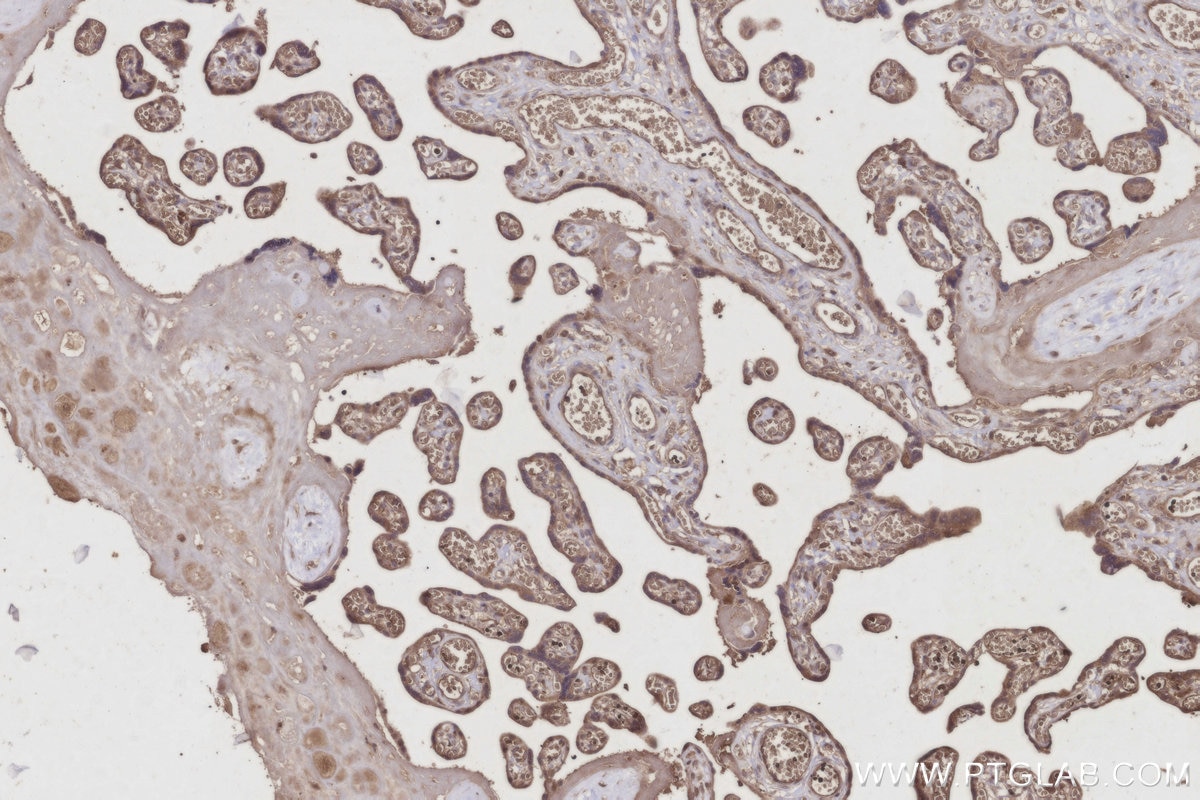 Immunohistochemistry (IHC) staining of human placenta tissue using C8orf4 Polyclonal antibody (26279-1-AP)