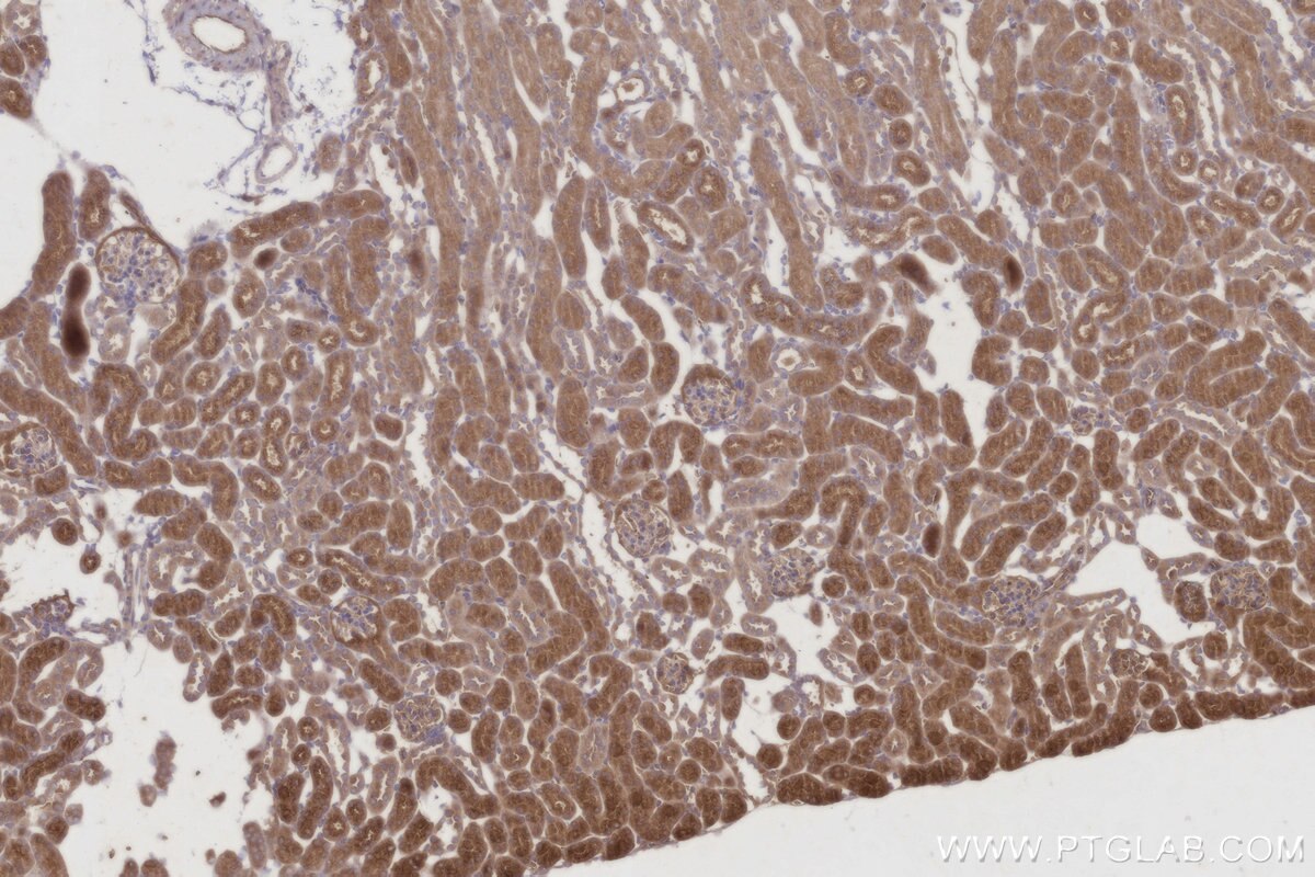 Immunohistochemistry (IHC) staining of mouse kidney tissue using C8orf4 Polyclonal antibody (26279-1-AP)