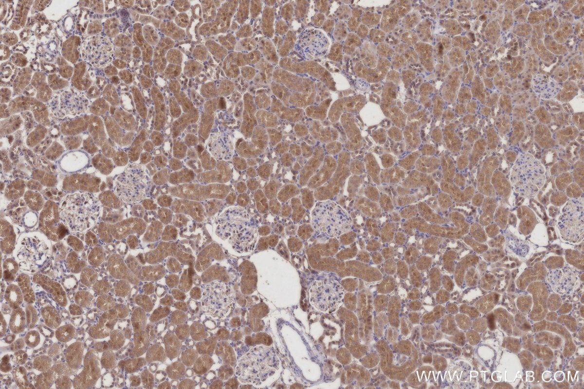 Immunohistochemistry (IHC) staining of rat kidney tissue using C8orf4 Polyclonal antibody (26279-1-AP)
