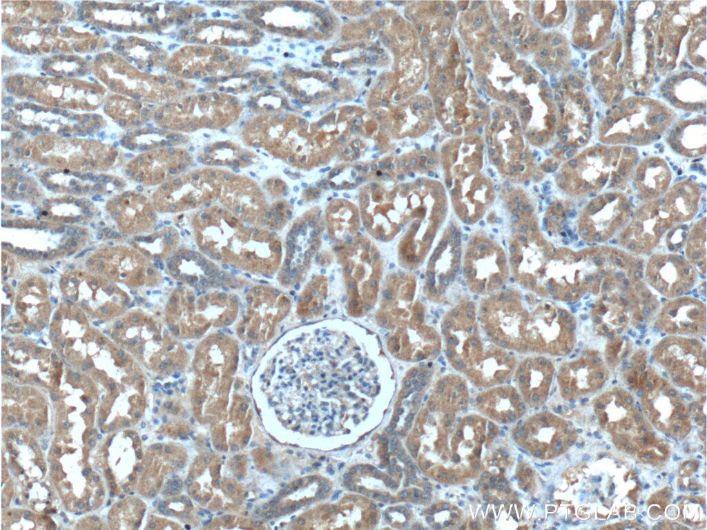 Immunohistochemistry (IHC) staining of human kidney tissue using C8orf4 Polyclonal antibody (26279-1-AP)