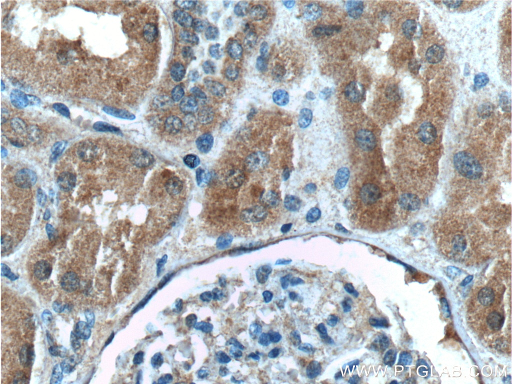 Immunohistochemistry (IHC) staining of human kidney tissue using C8orf4 Polyclonal antibody (26279-1-AP)