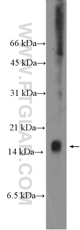 Western Blot (WB) analysis of mouse kidney tissue using C8orf4 Polyclonal antibody (26279-1-AP)