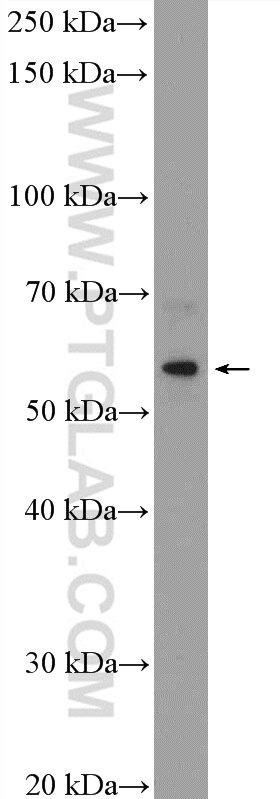 Western Blot (WB) analysis of HeLa cells using TTI2 Polyclonal antibody (20779-1-AP)