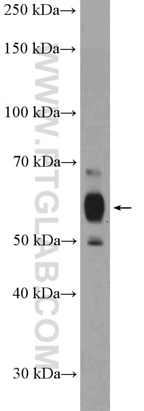 Western Blot (WB) analysis of HEK-293T cells using TTI2 Polyclonal antibody (20779-1-AP)