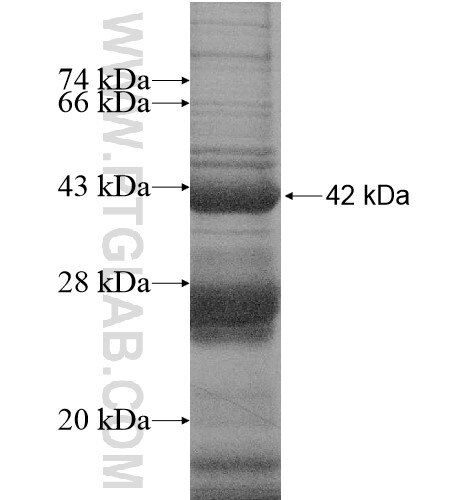 C8orf41 fusion protein Ag15641 SDS-PAGE