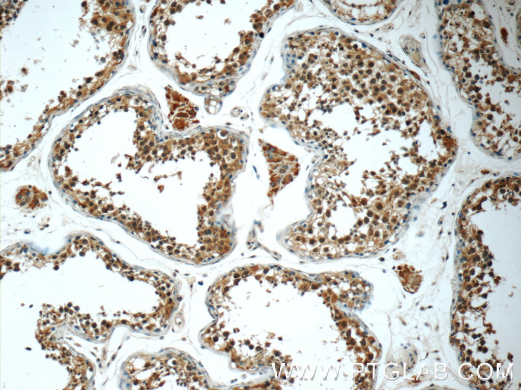 Immunohistochemistry (IHC) staining of human testis tissue using C8orf48 Polyclonal antibody (25020-1-AP)