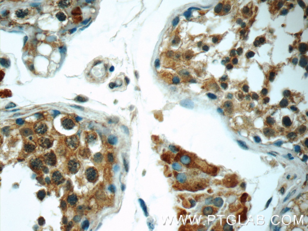 Immunohistochemistry (IHC) staining of human testis tissue using C8orf48 Polyclonal antibody (25020-1-AP)