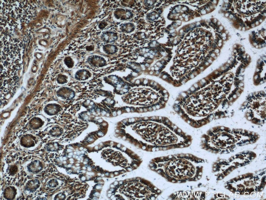 Immunohistochemistry (IHC) staining of human small intestine tissue using C8orf77 Polyclonal antibody (24549-1-AP)