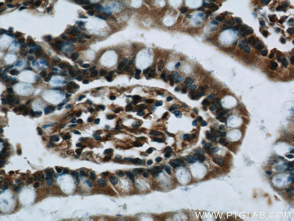 Immunohistochemistry (IHC) staining of human small intestine tissue using C8orf77 Polyclonal antibody (24549-1-AP)