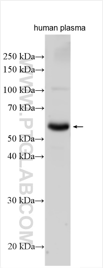 Western Blot (WB) analysis of human plasma using C9 Polyclonal antibody (25891-1-AP)