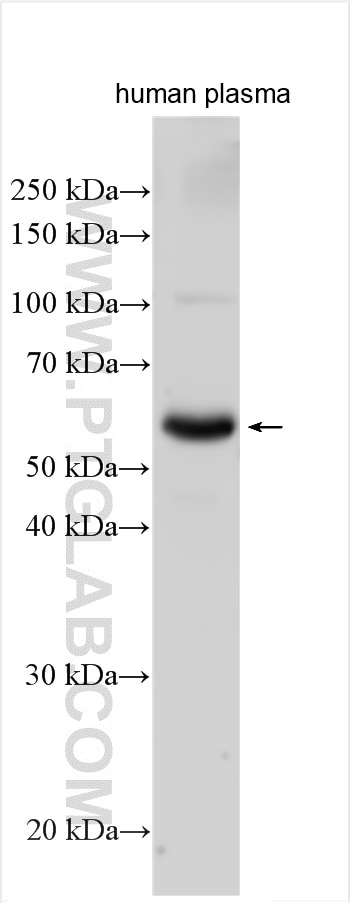 WB analysis of human plasma using 25891-1-AP