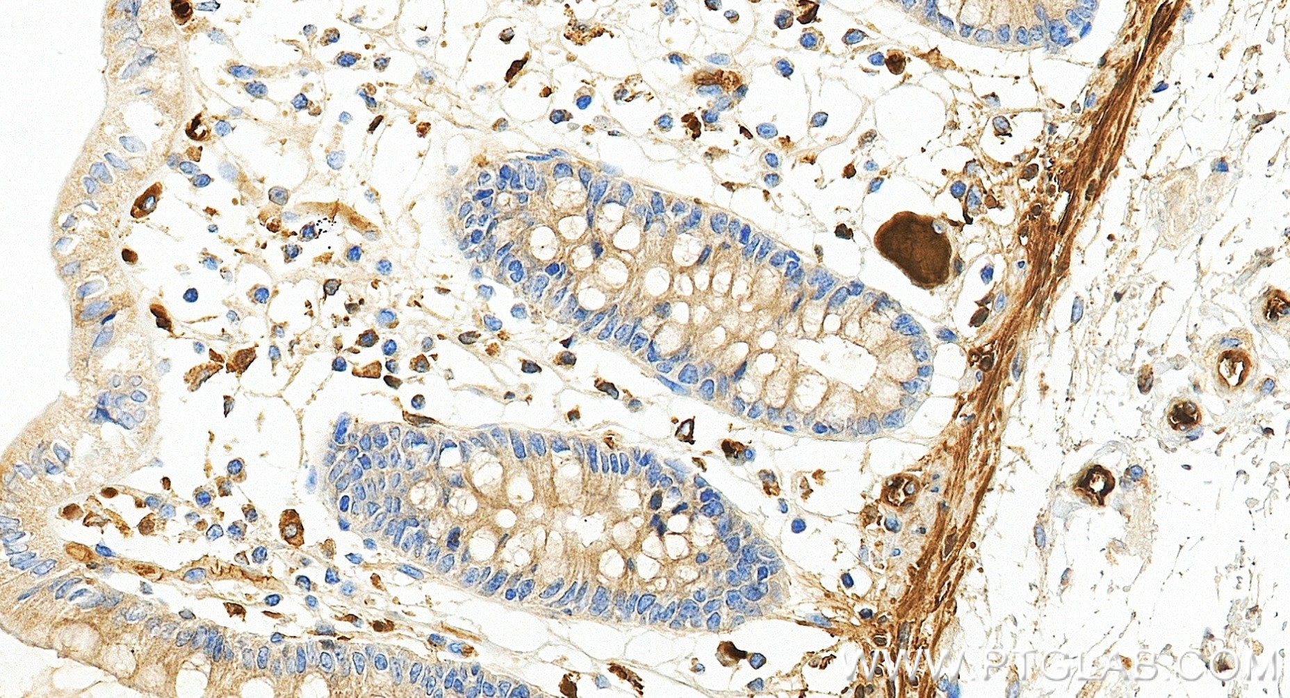 Immunohistochemistry (IHC) staining of human colon tissue using C9 Recombinant monoclonal antibody (84890-4-RR)