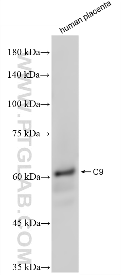 Western Blot (WB) analysis of human placenta tissue using C9 Recombinant monoclonal antibody (84890-4-RR)