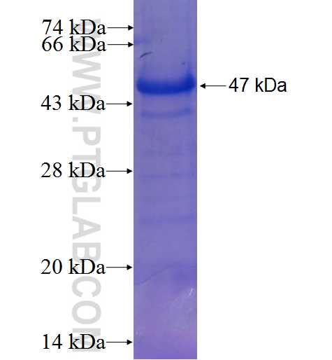 C9 fusion protein Ag23137 SDS-PAGE