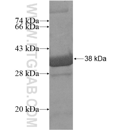 C9orf100 fusion protein Ag15504 SDS-PAGE