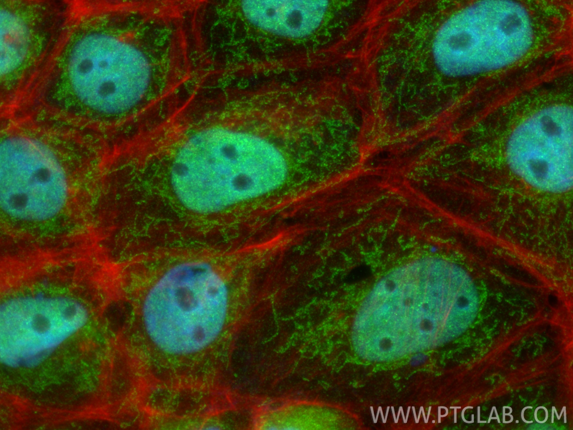 IF Staining of A431 using 27028-1-AP Immunofluorescence (IF) / fluorescent staining of A431 cells using ERCC6L2 Polyclonal antibody (27028-1-AP)