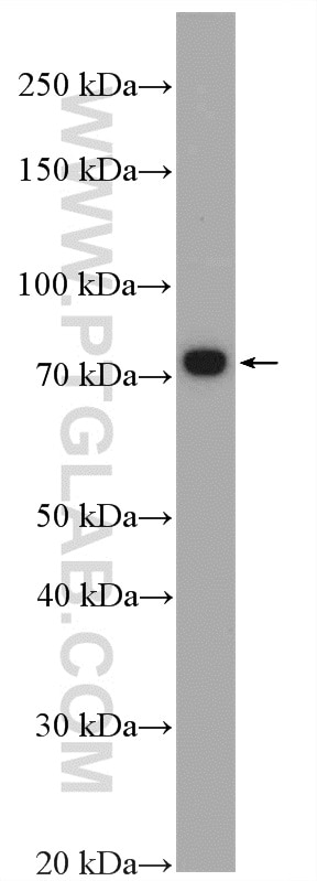 Western Blot (WB) analysis of PC-3 cells using ERCC6L2 Polyclonal antibody (27028-1-AP)