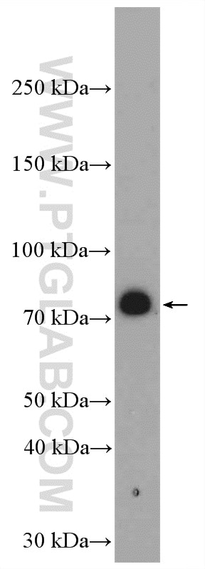 Western Blot (WB) analysis of HepG2 cells using ERCC6L2 Polyclonal antibody (27028-1-AP)