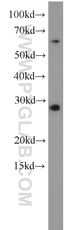 Western Blot (WB) analysis of HeLa cells using AFAF/EQTN Polyclonal antibody (23168-1-AP)