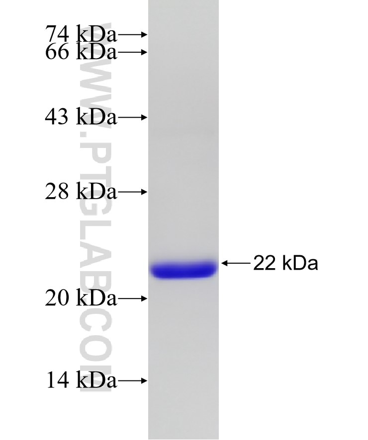 C9orf11 fusion protein Ag19656 SDS-PAGE